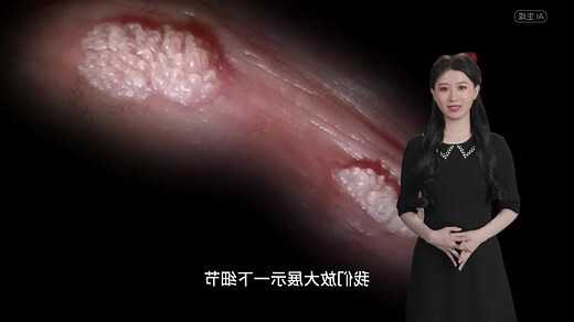 阴茎 痣